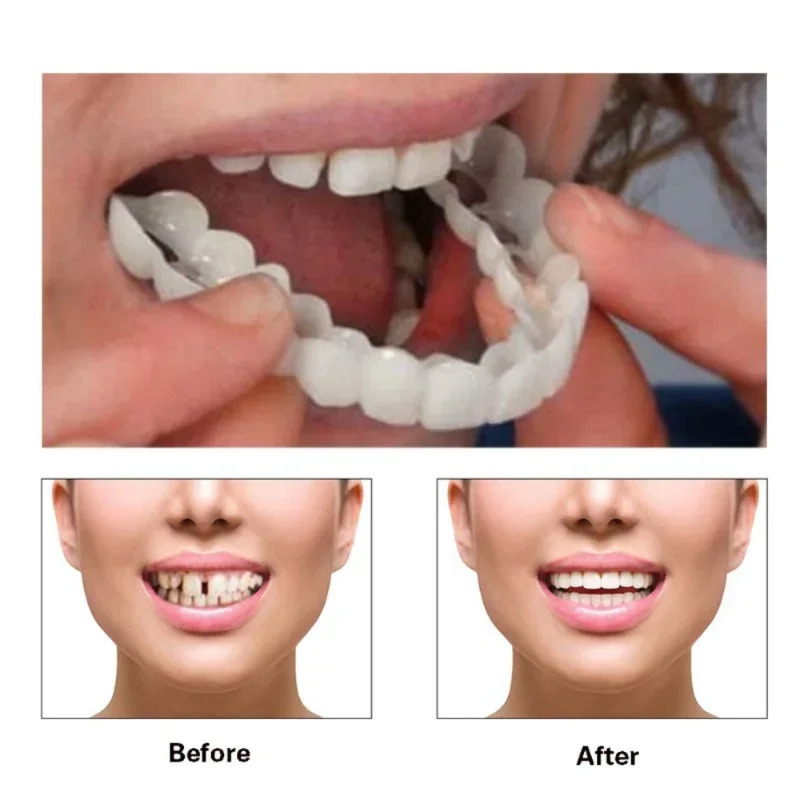 Quick Makeup Teeth Veneers, In - Beauty Makeup Look 리뷰 및 가격